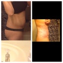 before and after