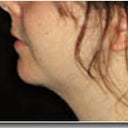 Face And Neck