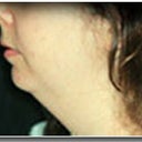 Face And Neck