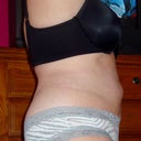 12 WKS POST OP--JUST SO STICKING OUT...UGHHHH