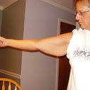 Flappy arms before surgery