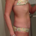 11 hrs post up tummy