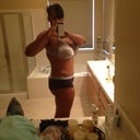 Dr.  Williams may have to lipo this side in 3 months... Too much skin!