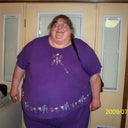 When surgery was first set. 600lbs! Organs starting to preserve water weight rapidly growing!