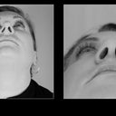 Improved airways - Before and After
