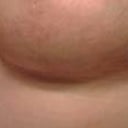 2 mths PO - Righty
