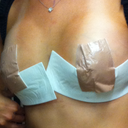 Day 2 after post-op appointment