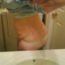 Tummy tuck pre-op