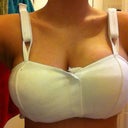 Day 3, Surgical Bra. Experiencing lots of swelling.