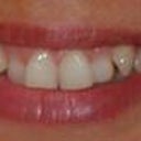 My teeth as of today 01.11.2010