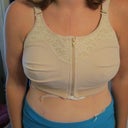 2 days post-op with bra
