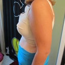 2 days post-op with bra (side view)