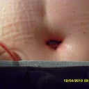 New belly button