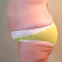 Side view.  The panties are holding me in.