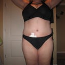 week 8 and you can see yet some more swelling has gone but PS said I am still quit swollen