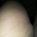 my inner thigh lump/bump