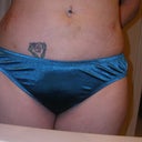 2 days post-surgery