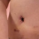 new tummy