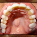 Teeth looked bigger because of the proximity to cam, but in reality, they are much smaller. Just look at inside mouth shot. Horrible!