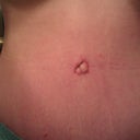 8 weeks up close of belly button..still red scar so no bikini yet!