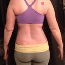 Post op day 9