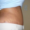 this is the lower side and it matches more with where my pants are.