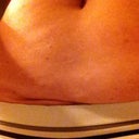 Before- c-section shelf pulled down to see.  This area has not responded to diet and exercise.