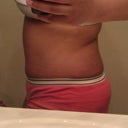 1 month...still swollen