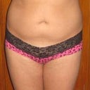 Consult Pic---Before