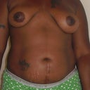 Full frontal incl. uneven breasts