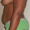 Side view