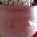 My teeth BEFORE treatment