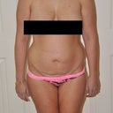 Front view before