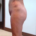 2-days post