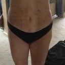 2-days post