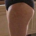 2-days post