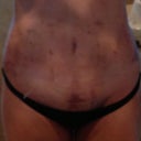 2-days post