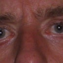 Picture taken with head facing straight
