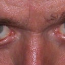 Looseness in eyelids...head tilted to lesser degree.