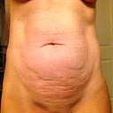 before pic