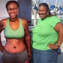 Comparison picture. I lost 180 pounds, naturally then I got my surgery. In this picture I am 6 weeks post-surgery!!!