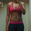 After my 5 session of Zerona