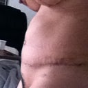 tummy is puffy