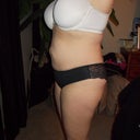23 weeks post op