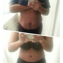 Before tt and 8 days p.o. Swollen but looks good! On my way to phineness