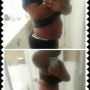 Before tt and 8 days p.o. Swollen but looks good! On my way to phineness