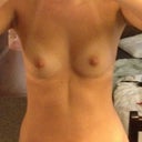 The before picture. I will try and put another picture up before surgery, I was by myself and my arms are up so it's kind of hard to tell.