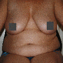 Pre-op