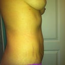 side vew