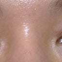 3 week post up